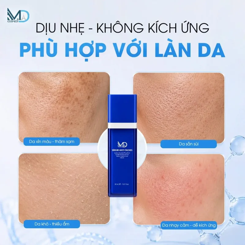 Dịu nhẹ, không kích ứng - phù hợp với làn da